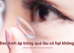 Đeo kính áp tròng có hại không? 5 Lưu ý quan trọng bảo vệ mắt hiệu quả